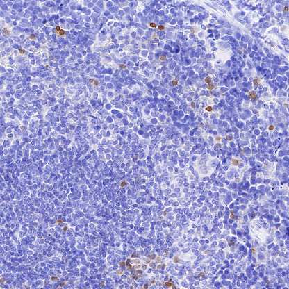 Stat4 Recombinant Rabbit mAb (S-4916-70)