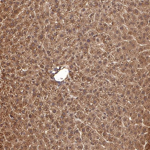CAD/BM1 Recombinant Rabbit mAb (S-1650-72)