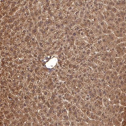 CAD/BM1 Recombinant Rabbit mAb (S-1650-72)