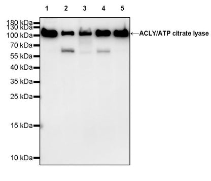 ACLY/ATP citrate lyase Recombinant Rabbit mAb (S-2025-32)