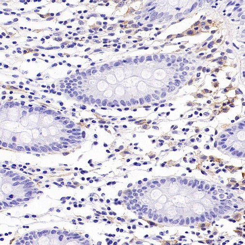 AXL Recombinant Rabbit mAb (S-2199-80)