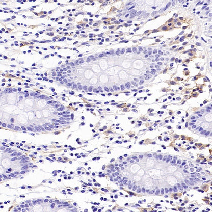 AXL Recombinant Rabbit mAb (S-2199-80)