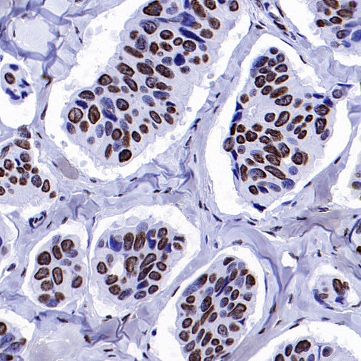 Histone H4 (acetyl K5 + K8 + K12 + K16) Recombinant Rabbit mAb (S-902-37)