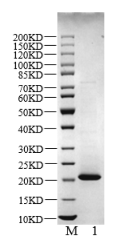 TMEM97 His Tag Protein, Human
