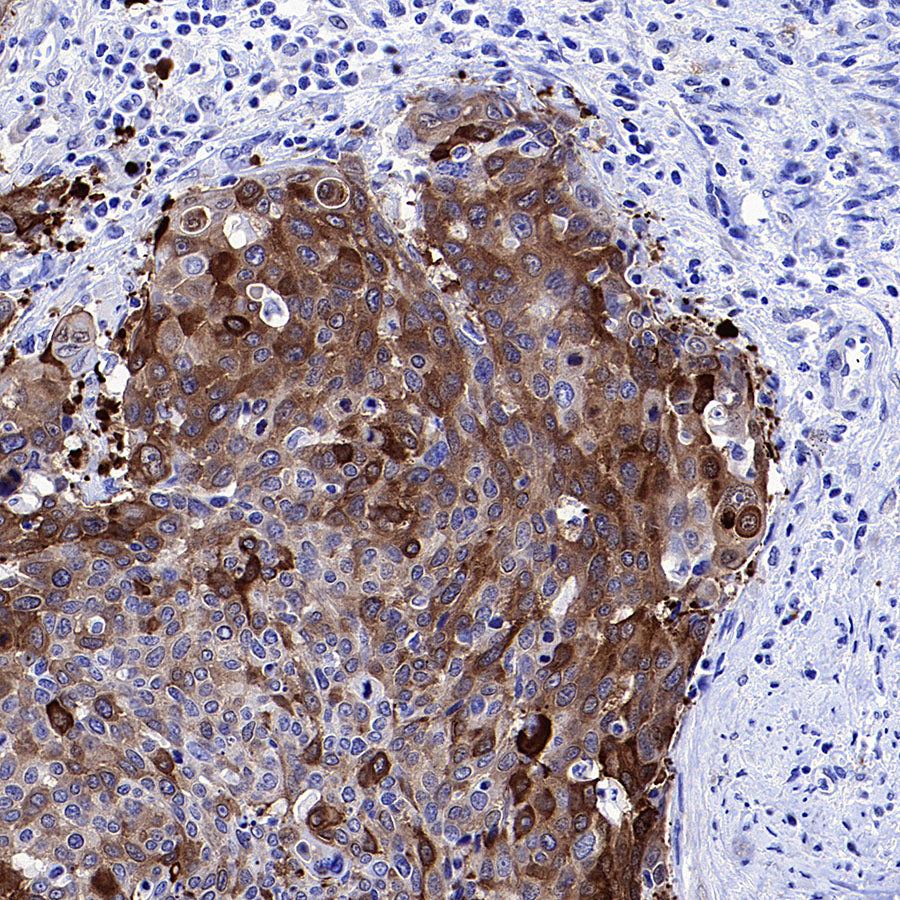 Phospho-HSP27 (Ser82) Recombinant Rabbit mAb (S-4792)