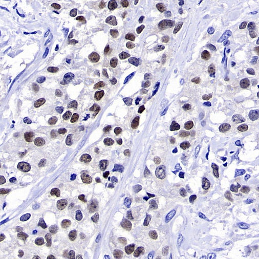 GATA3 Recombinant Mouse mAb (SDT-3180)