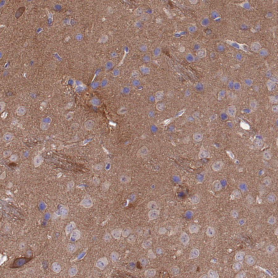 pan PDE4 Recombinant Rabbit mAb (S-5034)