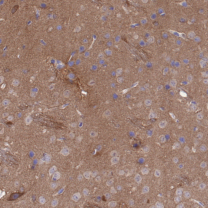 pan PDE4 Recombinant Rabbit mAb (S-5034)