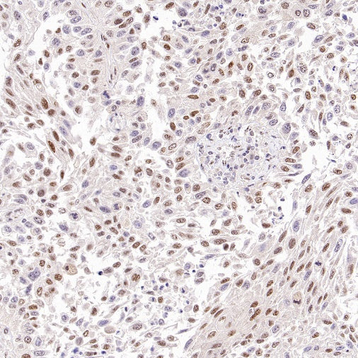 TDG Recombinant Rabbit mAb (S-3111-16)