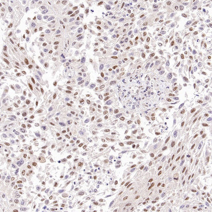 TDG Recombinant Rabbit mAb (S-3111-16)