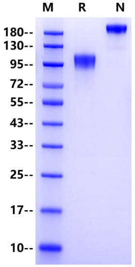 GUCY2C His Tag Protein, Human