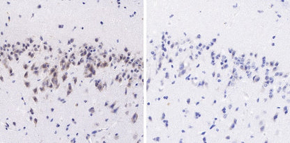 Tau (phospho S202+T205) Recombinant Mouse mAb (AT8)