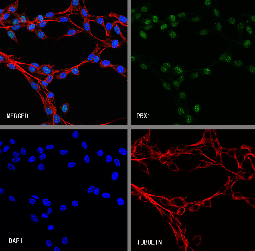 PBX1 Recombinant Rabbit mAb (S-4698-8)