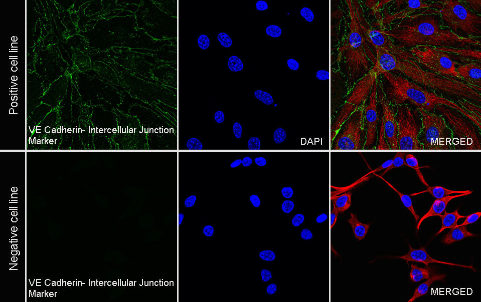 VE-Cadherin Recombinant Rabbit mAb (S-3312-5)