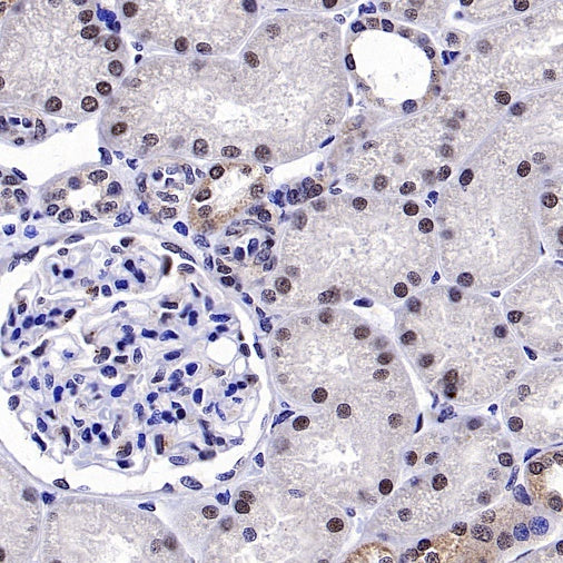 ALKBH5 Recombinant Rabbit mAb (S-2264-39)