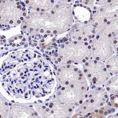 ALKBH5 Recombinant Rabbit mAb (S-2264-39)