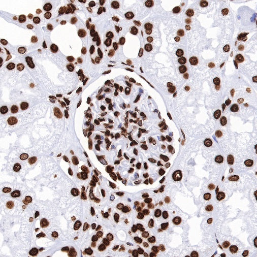 Histone H3 (tri methyl K27) Recombinant Rabbit mAb (SDT-431-118)