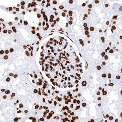 Histone H3 (tri methyl K27) Recombinant Rabbit mAb (SDT-431-118)