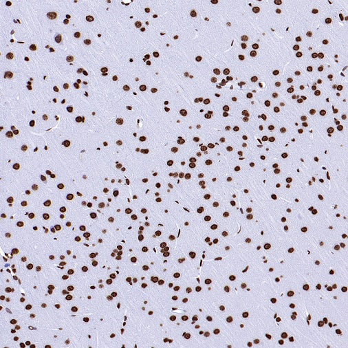 Histone H2A.X Recombinant Rabbit mAb (S-1772-179)