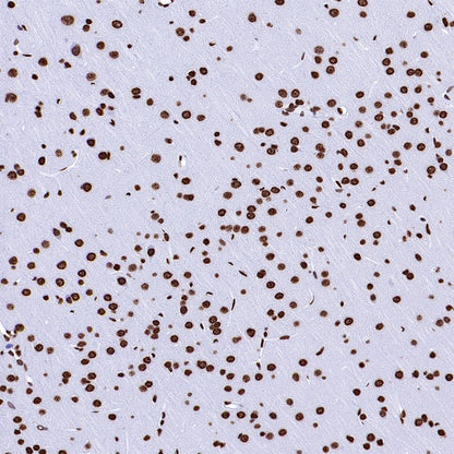 Histone H2A.X Recombinant Rabbit mAb (S-1772-179)