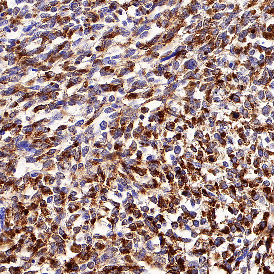 Tyrosinase Recombinant Rabbit mAb (S-5955)
