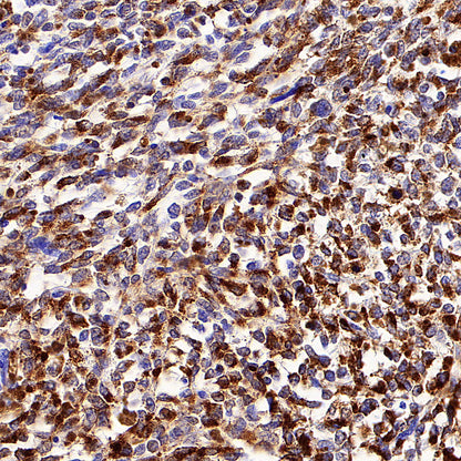 Tyrosinase Recombinant Rabbit mAb (S-5955)
