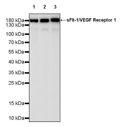 sFlt-1/VEGF Receptor 1 Recombinant Rabbit mAb (S-807-137)