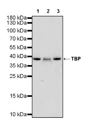 TBP Recombinant Rabbit mAb (S-886-57)
