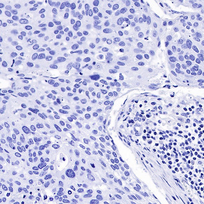α-Synuclein Recombinant Rabbit mAb (S-441-86)
