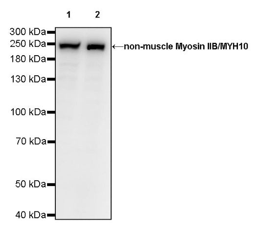 Non-muscle Myosin IIB/MYH10 Recombinant Rabbit mAb (S-299-3)