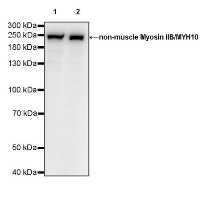 Non-muscle Myosin IIB/MYH10 Recombinant Rabbit mAb (S-299-3)