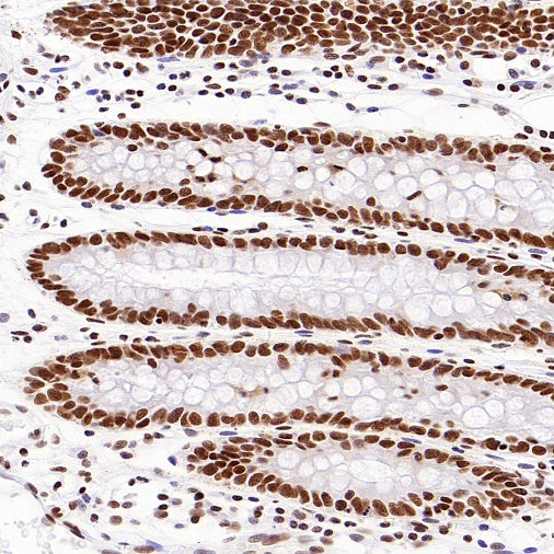 HDAC3 Recombinant Rabbit mAb (S-1977-31)