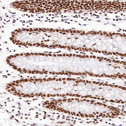 HDAC3 Recombinant Rabbit mAb (S-1977-31)