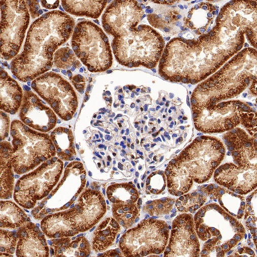 Glutathione Peroxidase 1 Recombinant Rabbit mAb (S-1714-17)