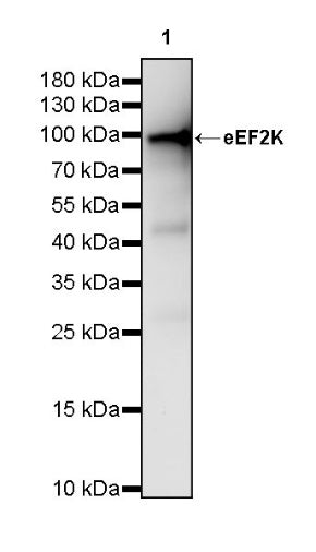eEF2K Rabbit Polyclonal Antibody
