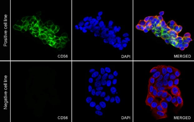 CD56 Recombinant Rabbit mAb (SDT-2427-1)