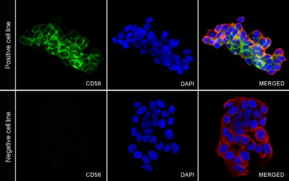 CD56 Recombinant Rabbit mAb (SDT-2427-1)