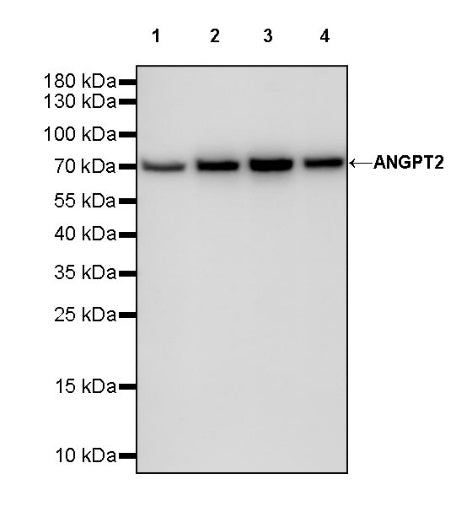 ANGPT2 Recombinant Rabbit mAb (S-1768-2)