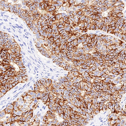 Claudin 1 Recombinant Rabbit mAb (SDT-1289-55)