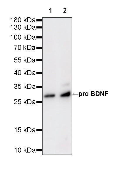 BDNF Recombinant Rabbit mAb (S-4118-38)