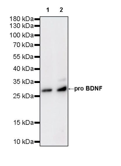 BDNF Recombinant Rabbit mAb (S-4118-38)
