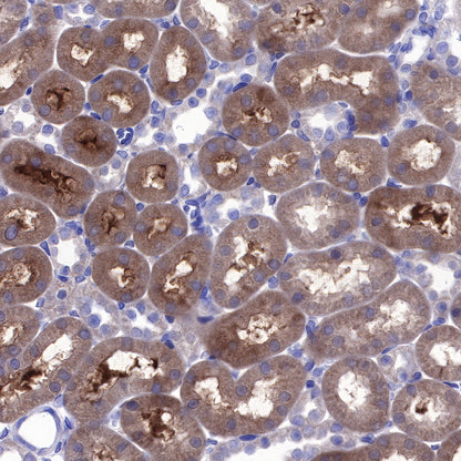 BAX Recombinant Rabbit mAb (SDT-338-76)