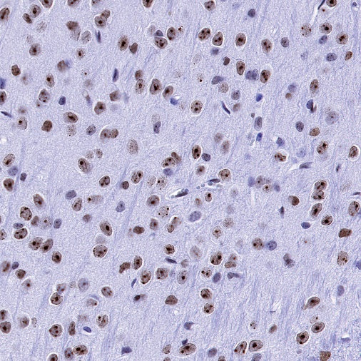 H2AFY Recombinant Rabbit mAb (S-1256-35)