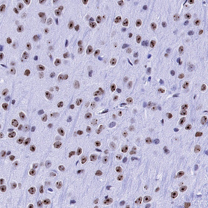 H2AFY Recombinant Rabbit mAb (S-1256-35)