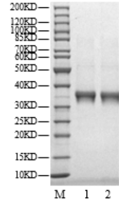 FGFR1 His&Strep Tag Protein, Human