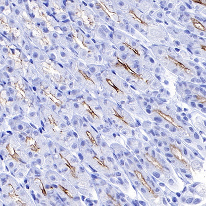 MUC1/EMA Mouse mAb (SDT-777-37)