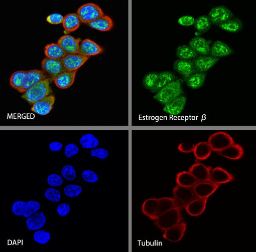 Estrogen Receptor β Recombinant Rabbit mAb (S-1396-67）