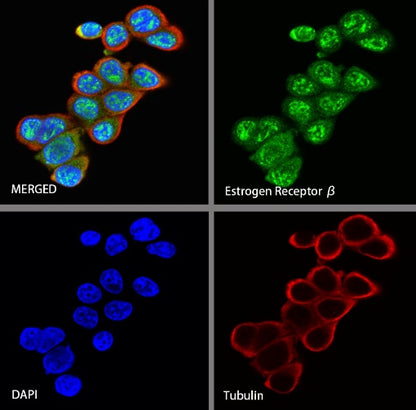Estrogen Receptor β Recombinant Rabbit mAb (S-1396-67）