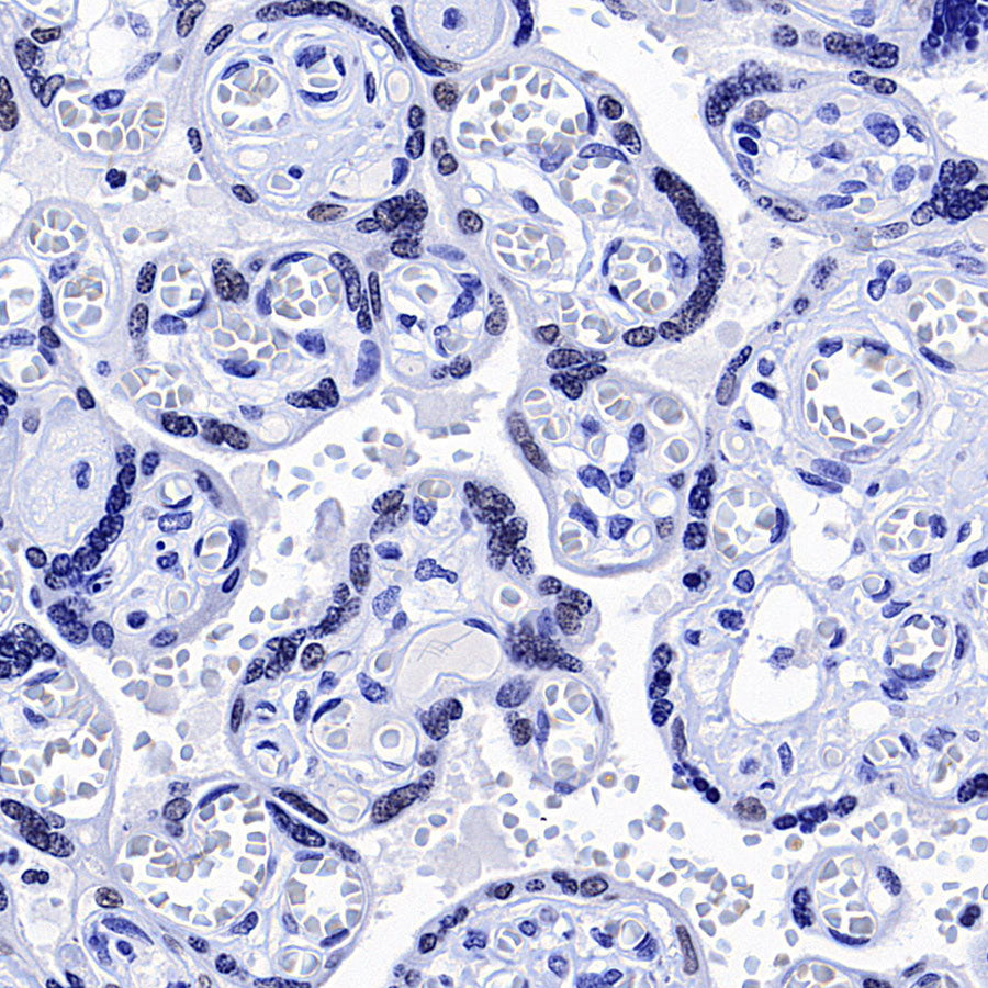 CEBPA Recombinant Rabbit mAb (S-3629-33)
