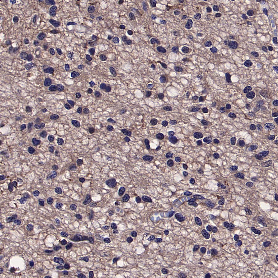 TREM2 Recombinant Rabbit mAb (S-5570)